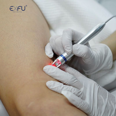 Portable HIFU Beauty Machine 0.1J-2.5J Energy Output for Face Lifting